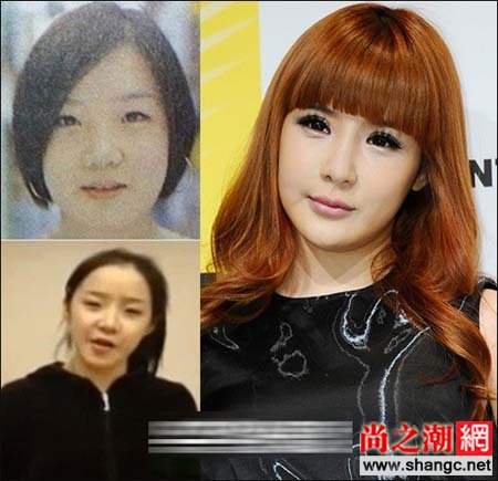 2NE1朴春承认整容 整容前后照片对比_www.shangc.net