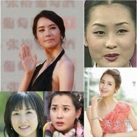 李多海领衔 16位中韩女星整容前后PK【图】