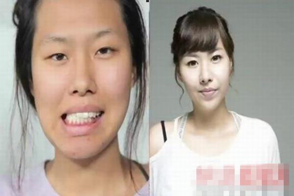 韩国整形节目《LET美人2》近期十分火爆，因为该节目找来一些真正的素人，这些女性素人几乎都是被外貌所困扰，透过节目以及整形医生的协助，得以重生。