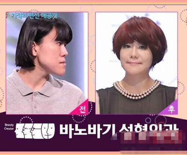 韩国整形节目《LET美人2》近期十分火爆，因为该节目找来一些真正的素人，这些女性素人几乎都是被外貌所困扰，透过节目以及整形医生的协助，得以重生。