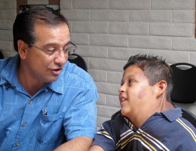 墨西哥9男孩脖子肩膀长出巨可怕的肿瘤2