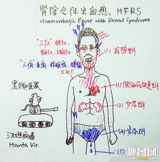 某医学系同学神一般的笔记 你能看懂多少15