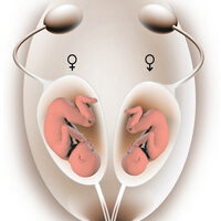 双子宫是怎么回事