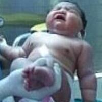 世上最重女婴：生下来就有14斤重