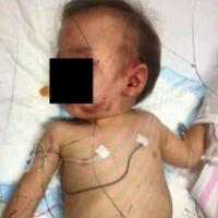 一岁半男婴遭虐打，造成男婴两耳鼓膜破裂头部及肋骨骨折